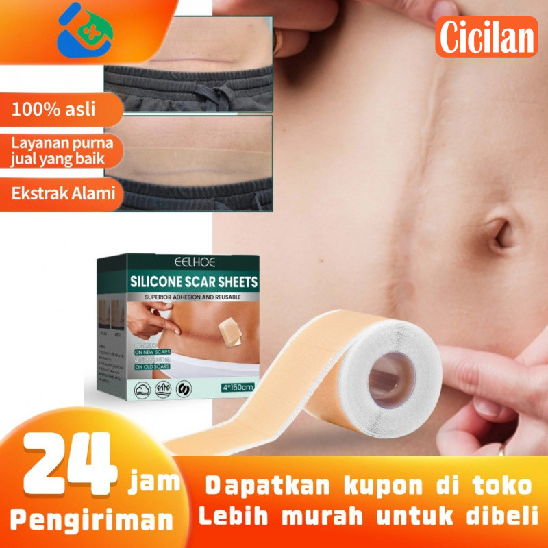 EELHOE Silicone Scar Sheet  Plester Silikon penghilang bekas luka keloid uk Plester Silikon 1pcs - M
