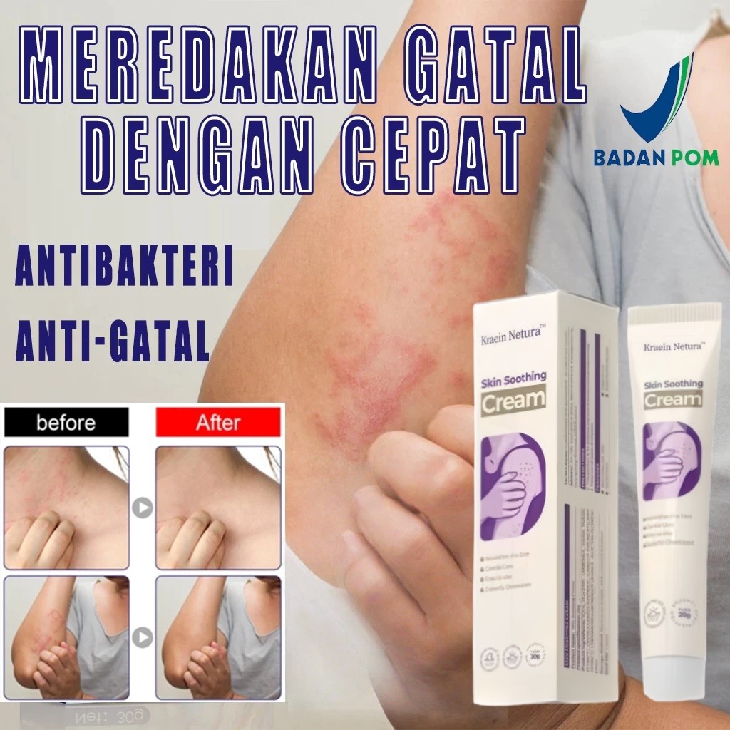 Kreain Nature Skin Soothing Cream 20g Salep Gatal Paling Ampuh Salep Gatal Obat Gatal Selangkangan O