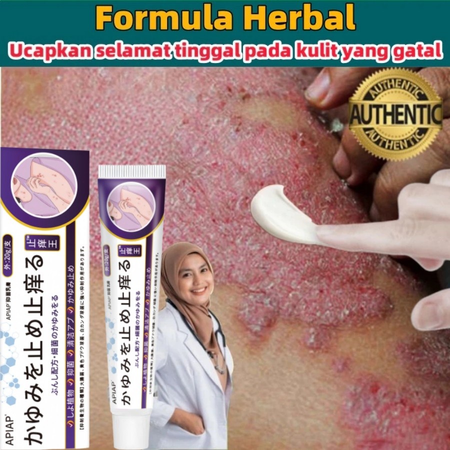 Obat Gatal 20g Obat Gatal Selangkangan Psoriasis Psoriasis Cream Obat Psoriasis Obat Gatal Psoriasis