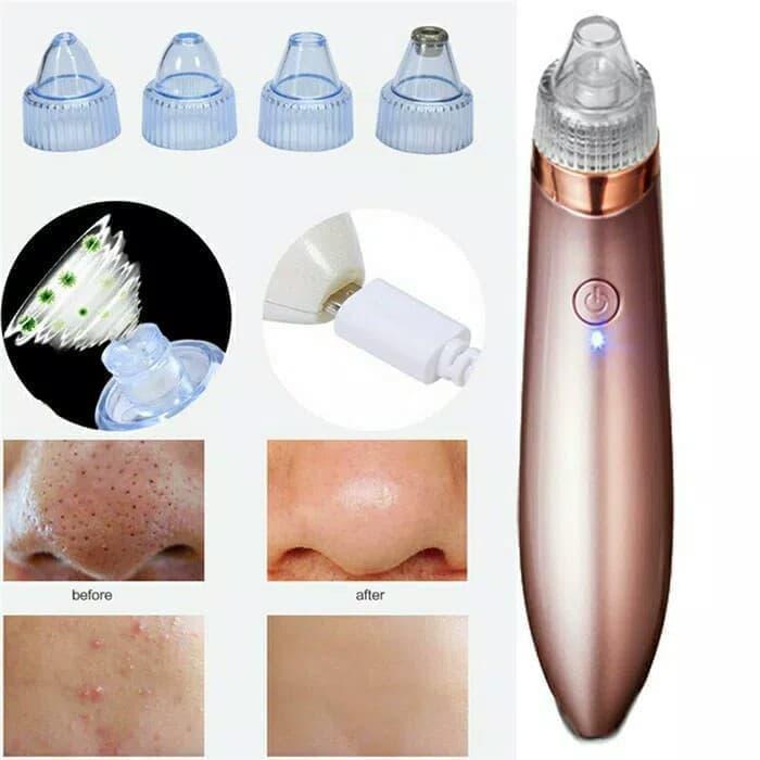 Alat Penyedot Komedo Listrik / Vacuum Komedo /Mengangkat Komedo Wajah