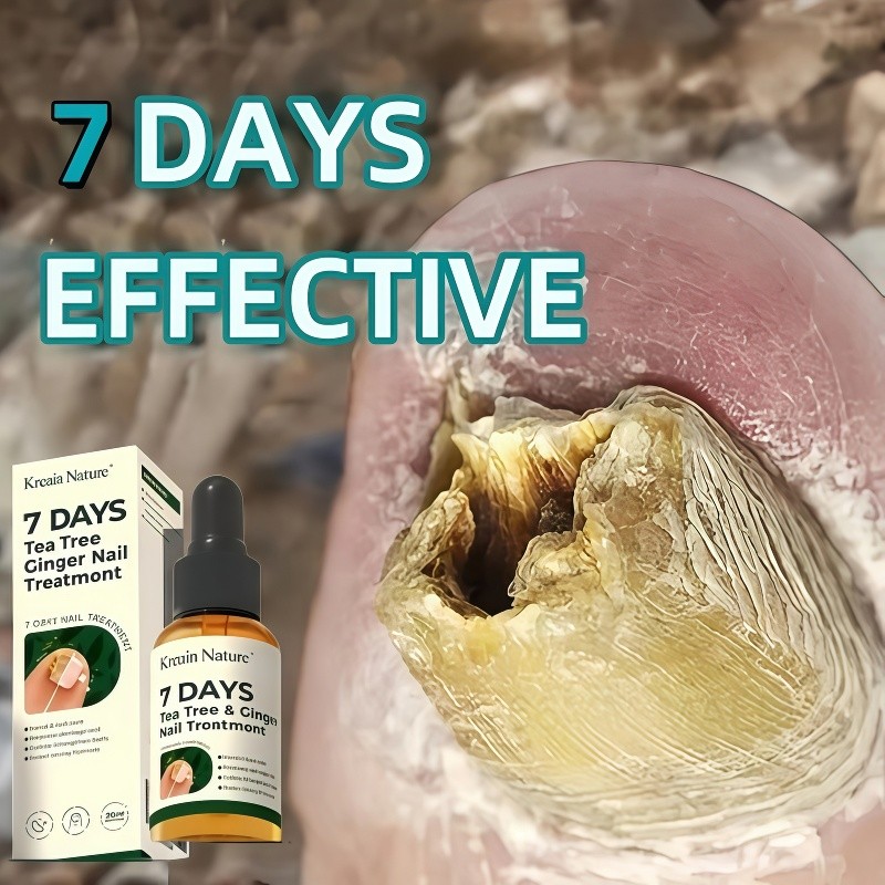 serum kuku jamur dan rusak obat kuku 30ml Jamur kuku Salep kuku jamur dan rusak Obat kuku Jamur kuku