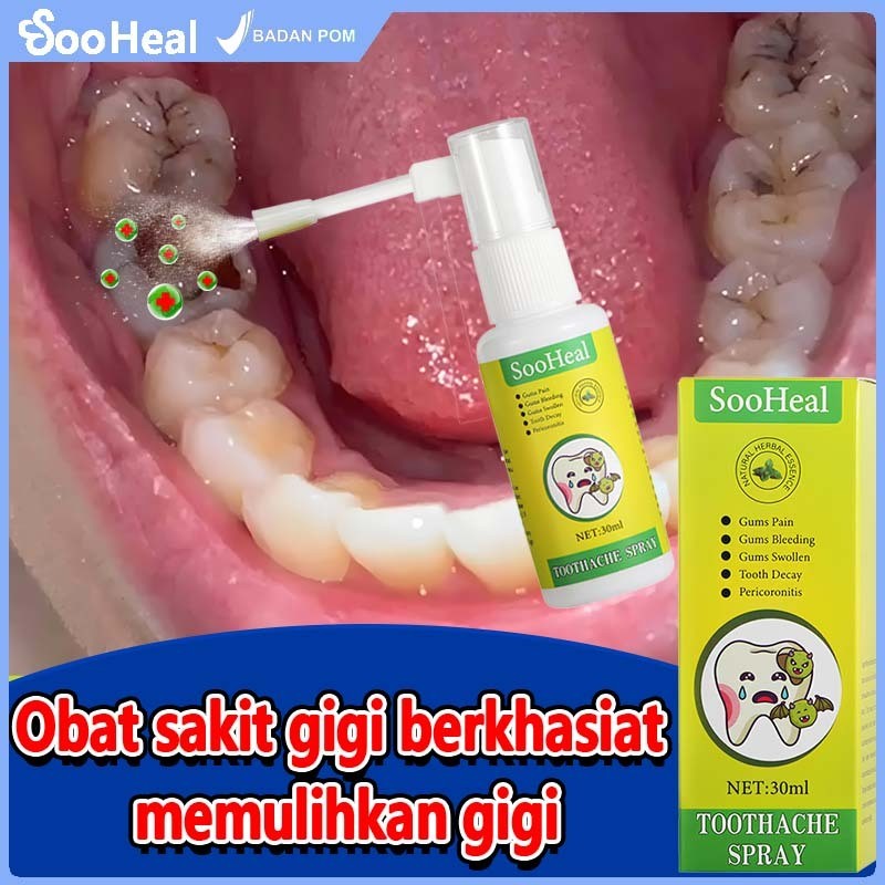 Paket Spray Sakit Gigi  - Spray Sakit Gigi (Sakit Gigi Ampuh, Obat Sakit Gigi, Obat Sakit Gigi Berlu