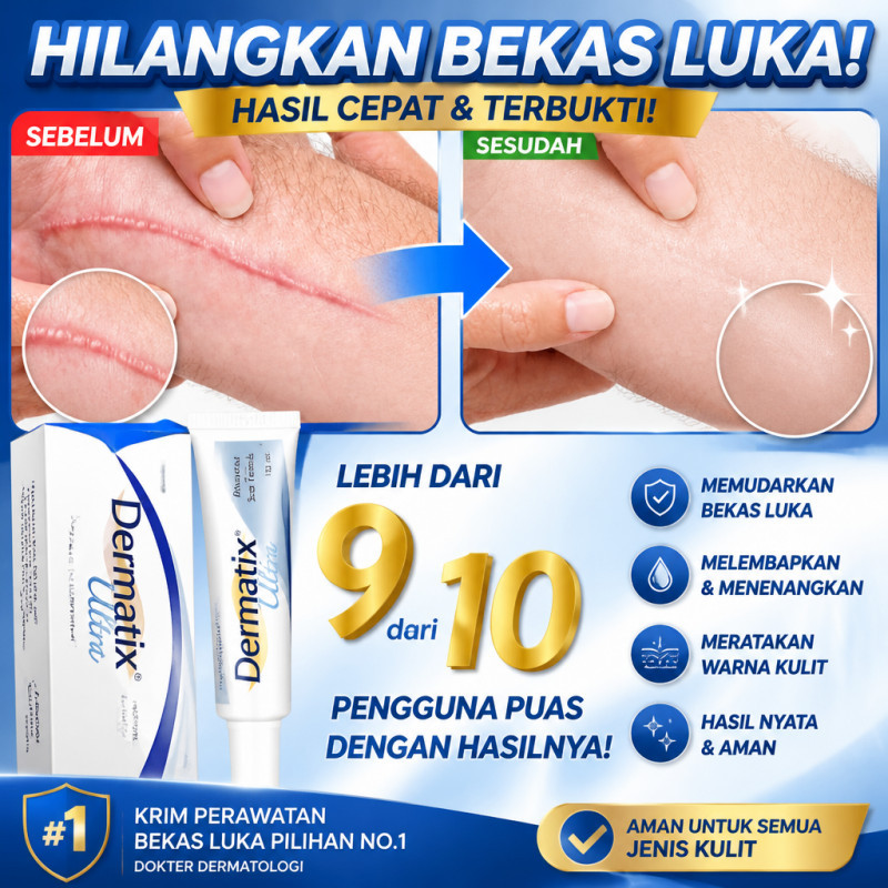 *Beli 2 Gratis 1*Dermatix Penghilang Bekas Luka / Dermatix Ultra Gel 15gr Obat Bekas Luka Koreng / S
