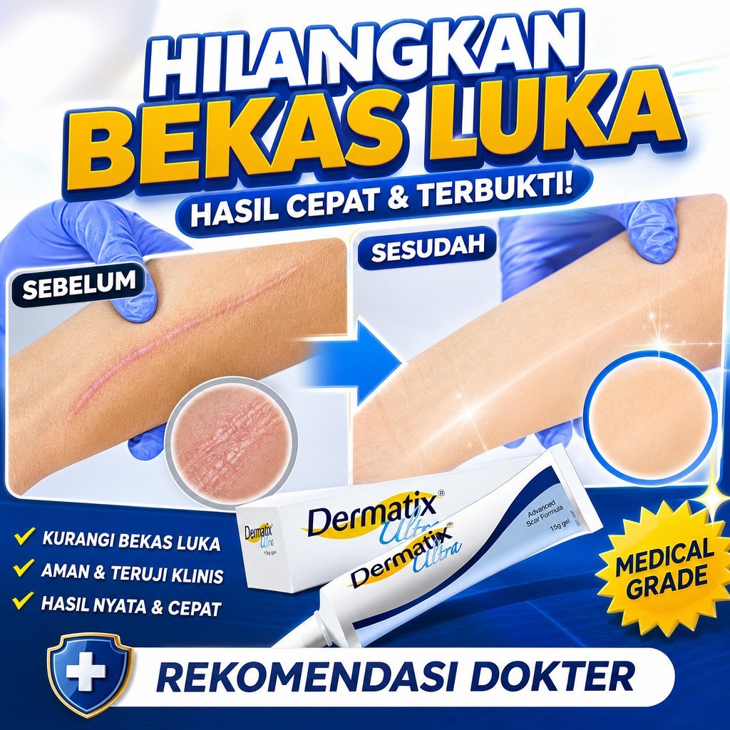 *Beli 2 Gratis 1*Dermatix Ultra Gel 15gr Dermatix Penghilang Bekas Luka / Dermatik Penghilang Bekas 