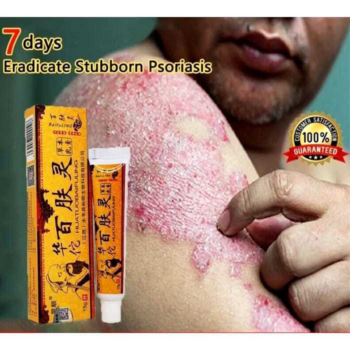 1pcs HUATUOBAEFULING, obat gatal selangkangan, 0bat kurap gatal gatal kulit, salep jamur kulit, sale