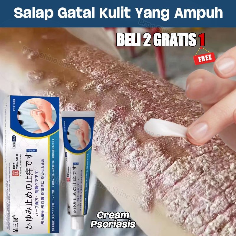 Krim Gatal Cream Psoriasis Salap Gatal Kulit Yang Ampuh Obat Eksim Selangkangan Eksim Dan Jamur Gata