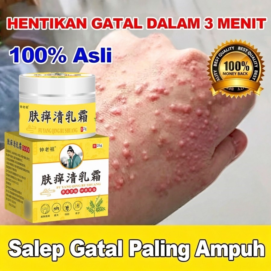 salep china gatal paling ampuh Salep Eksim Kering dan Gatal Salep Bayi Untuk Kulit Iritasi obat eksi