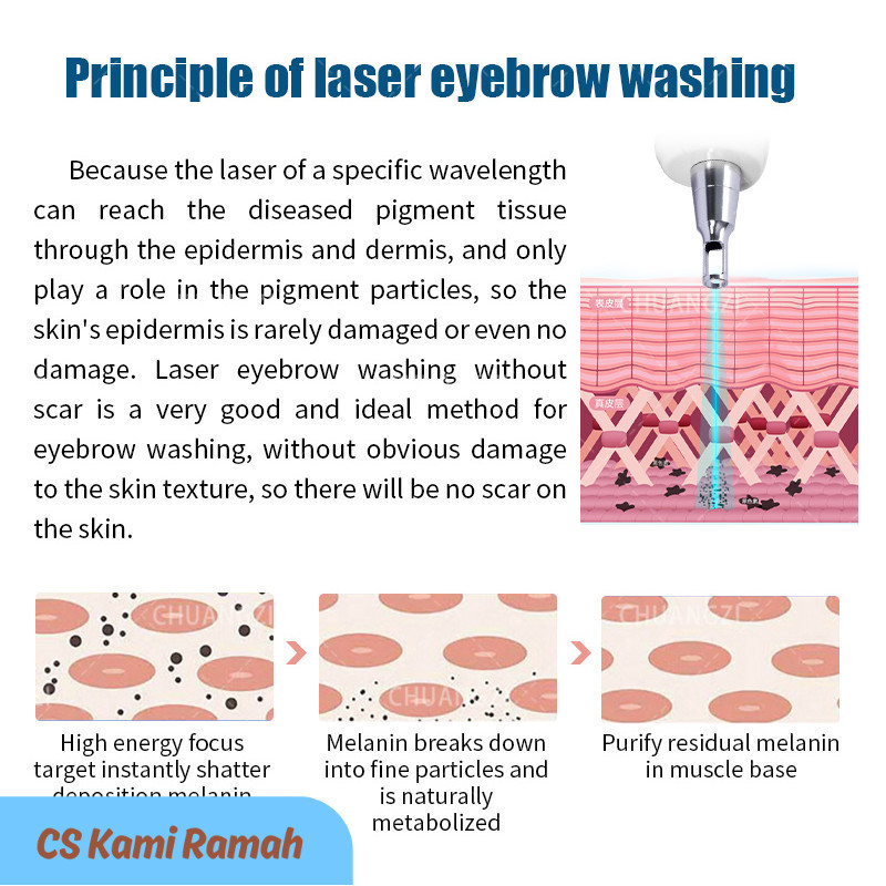 TBT CE Portable q switch nd yag laser tattoo removal machine 1064nm 532nm 1320nm skin whitening pigm