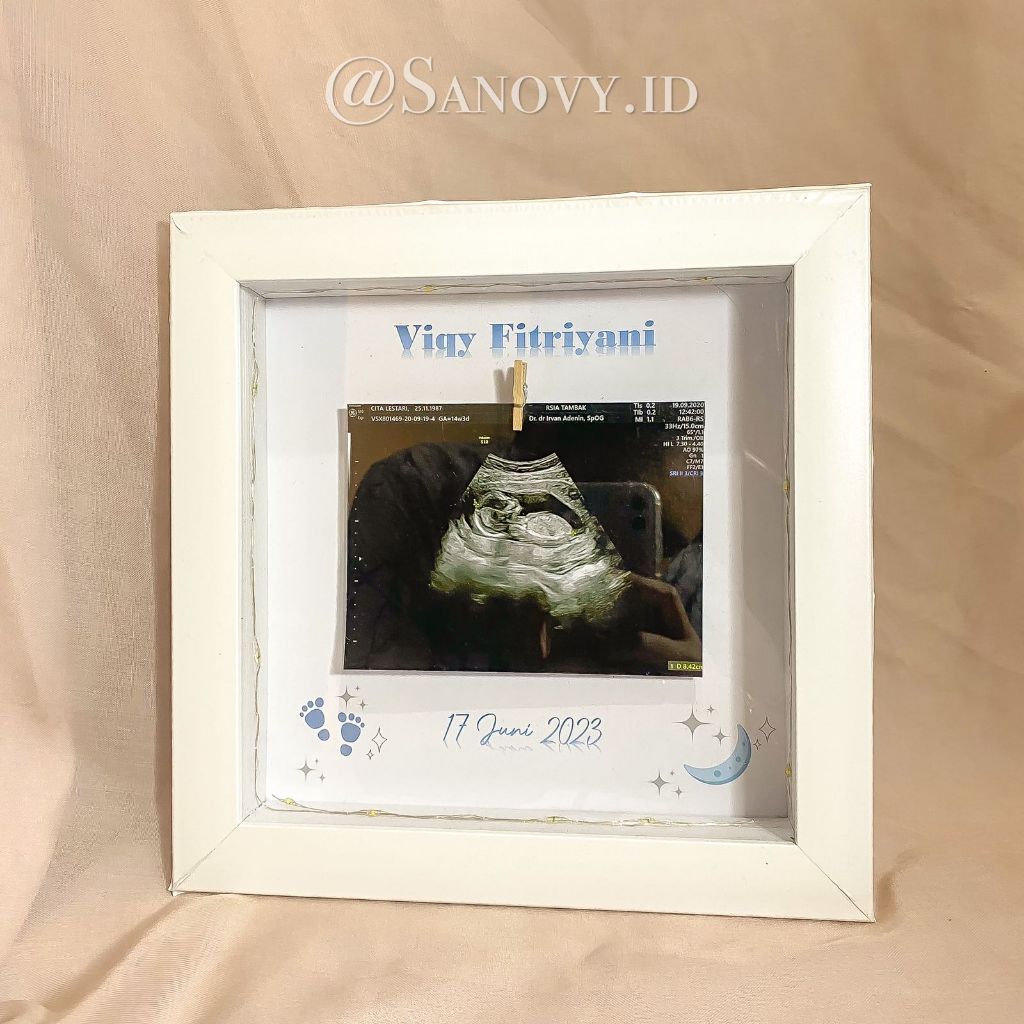 2020012 Pigura / frame 3d USG Baby Photo Frame