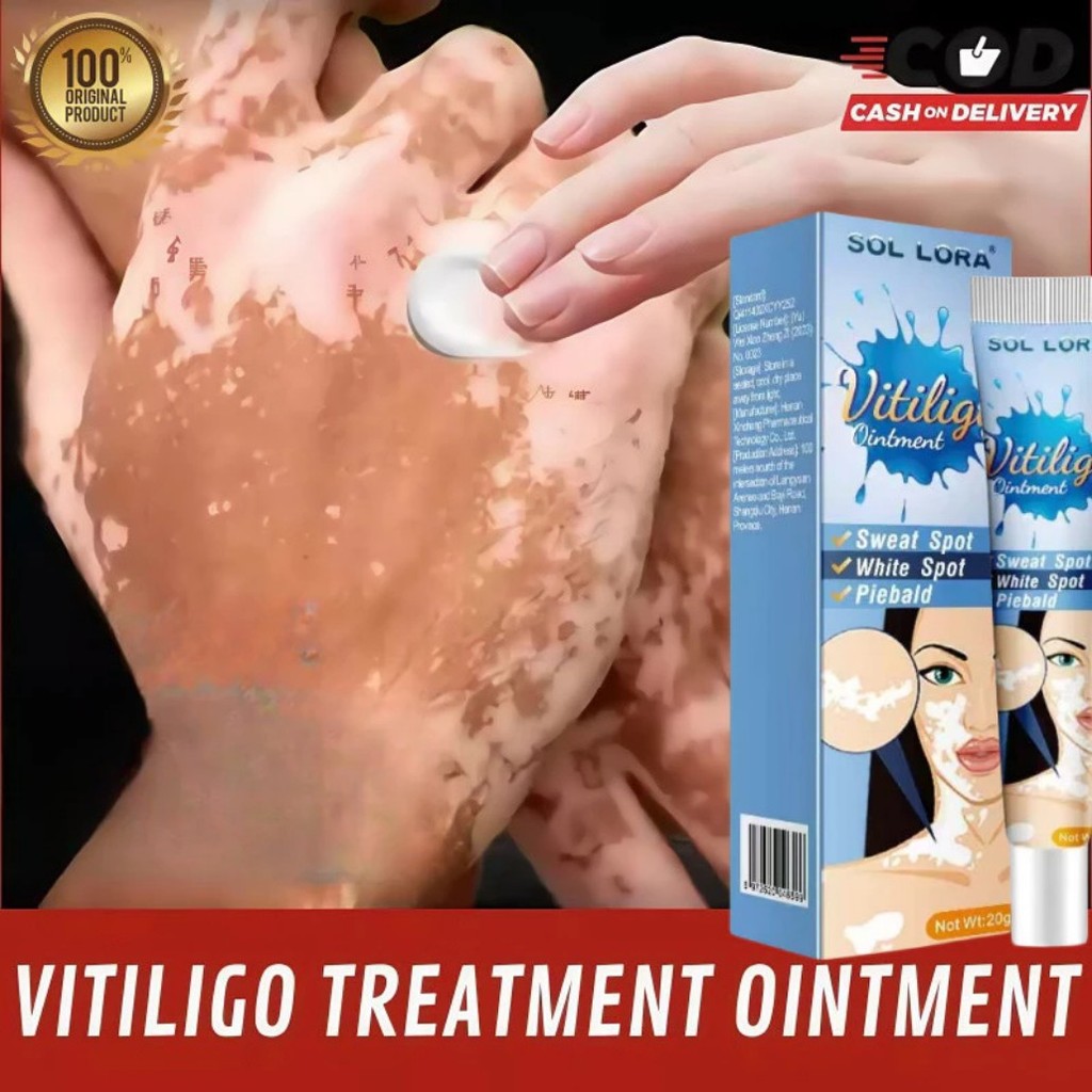 Salep Bintik Putih Vitiligo 20g Salep Panu Krim Perawatan Kulit Belang Bercak Putih Biang Keringat K