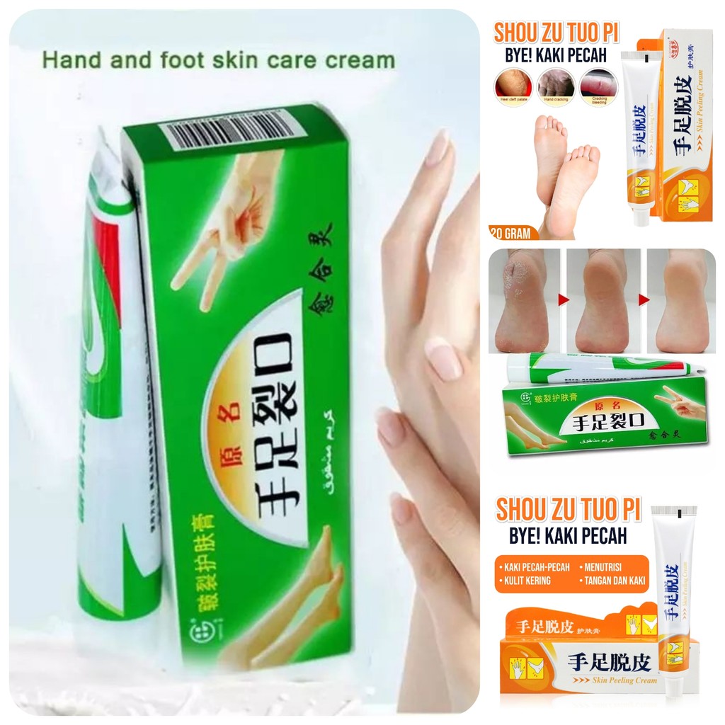 Salep Obat Tumit Pecah Pecah Ampuh Atasi Kaki Kering Kasar Kapalan Tebal Lembutkan Kulit Kaki Tangan