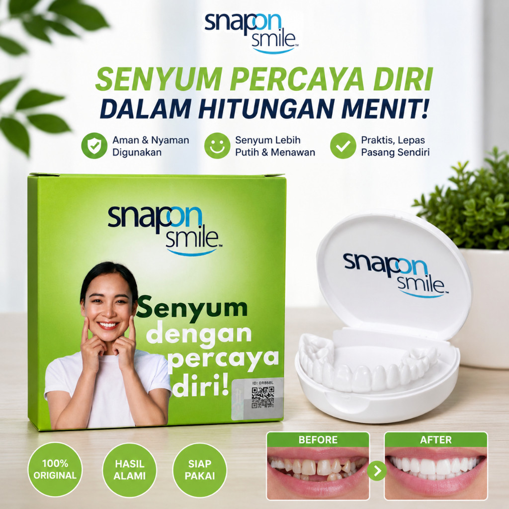 Sepasang atas bawah snap on smile veneer gigi