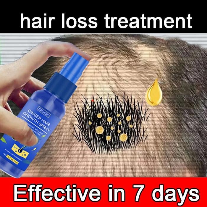 Penumbuh Rambut Botak Serum Penumbuh Rambut Anti Rontok / Obat rambut botak / PENUMBUH RAMBUT Cairan