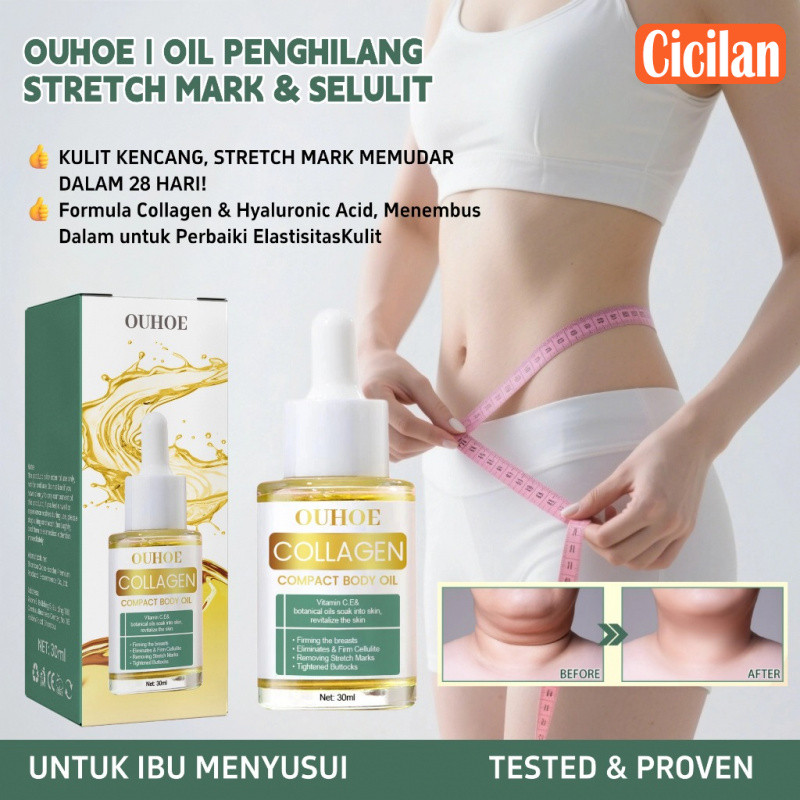 OUHOE Minyak Pembakar Lemak 30ml | Cicilan |  Ampuh Hilangkan Stretch Mark & Selulit | Fokus Pada Pe