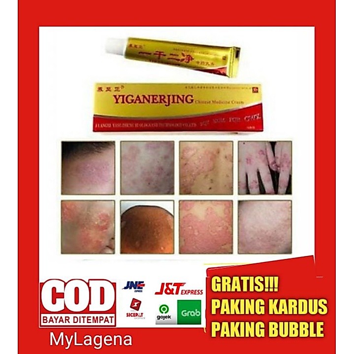 OBAT GATAL EKSIM BASAH DAN EKSIM KERING