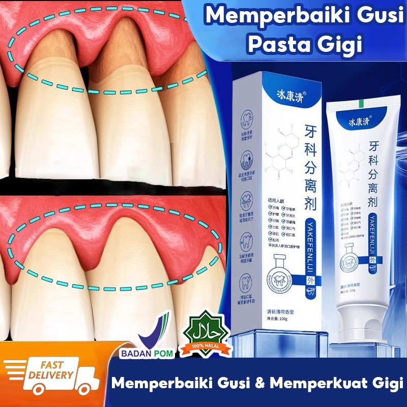 pasta gigi untuk gigi goyang pasta gigi goyang odol sakit gigi dan gusi pasta gigi dokter gigi goyan