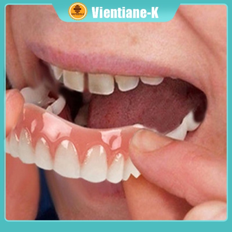 Gigi Palsu / Perfect Smile Veneer Gigi Tiruan / Instan Gigi Veneer