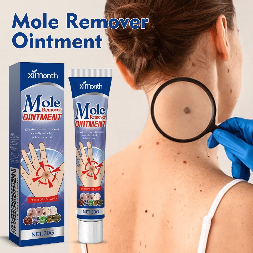 Ximonth  Salep Penghilang Tahi Lalat Dan Kutil 20g  Krim Penghilang Kutil Krim Penghilang Kutil Waja