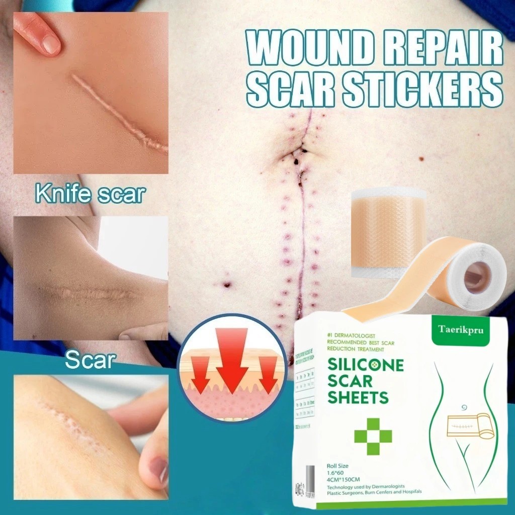 Taerikpru Silicone Scar Sheet Gel  4CM*150CM silikon penghilang keloid bekas luka Plester Bekas Luka