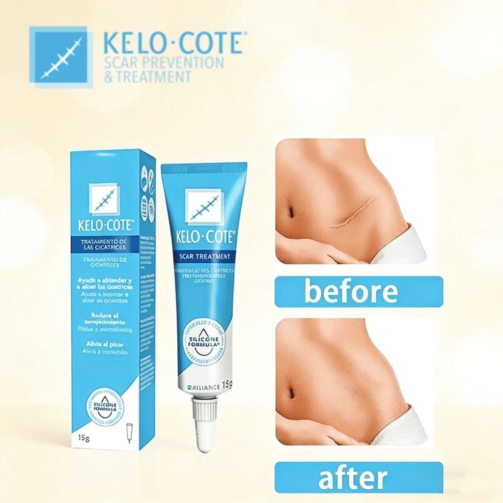 Kelo Cote Original Advanced Formula Scar Gel 15g/Kelo-Cote U.S.Edition Scar removal Gel Penghilang B