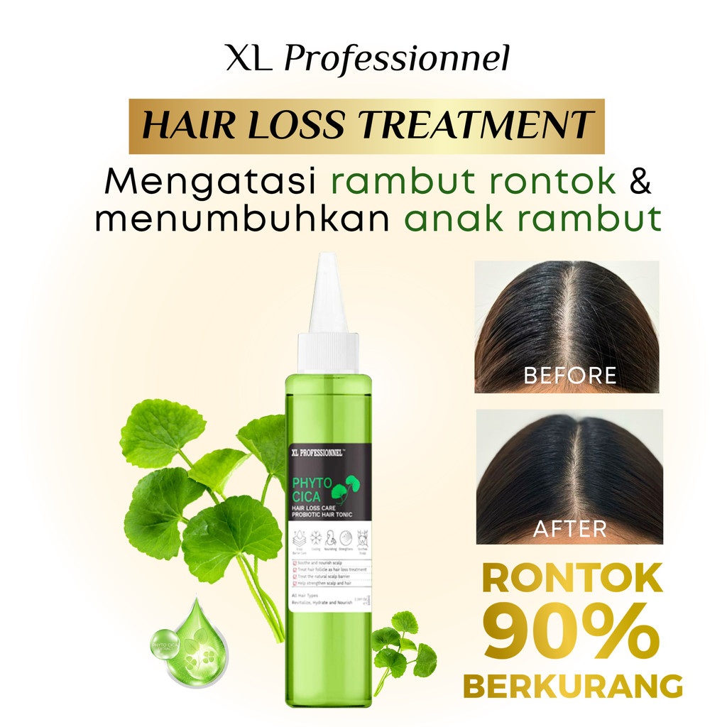 XL Professionnel Hair Loss Treatment Phyto Cica Hair Tonic - Perawatan rambut rontok, penumbuh rambu