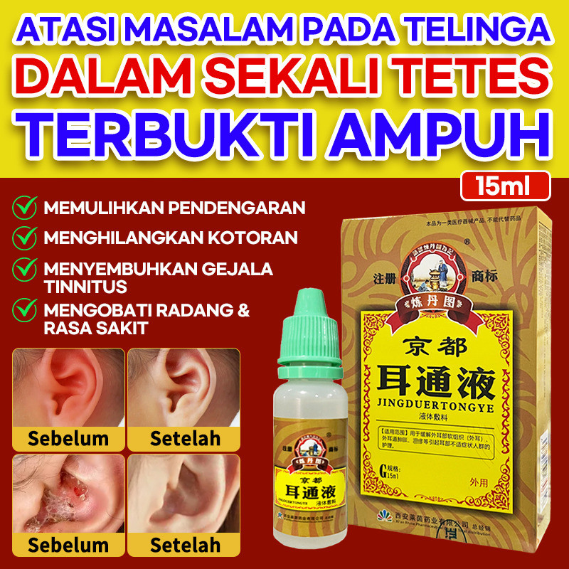 Redakan Gatal Telinga Secara Alami  Tetes Telinga Herbal Alami Tetes Telinga/Obat Telinga/Herbal Tel