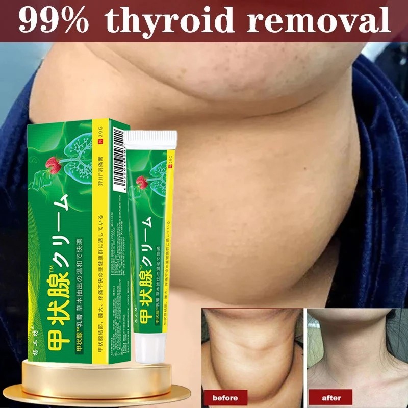COD Jepang Salep Tiroid Obat Benjolan Di Leher Obat Gondok 20g Benjolan Di Leher Tumor Kelenjar Tiro