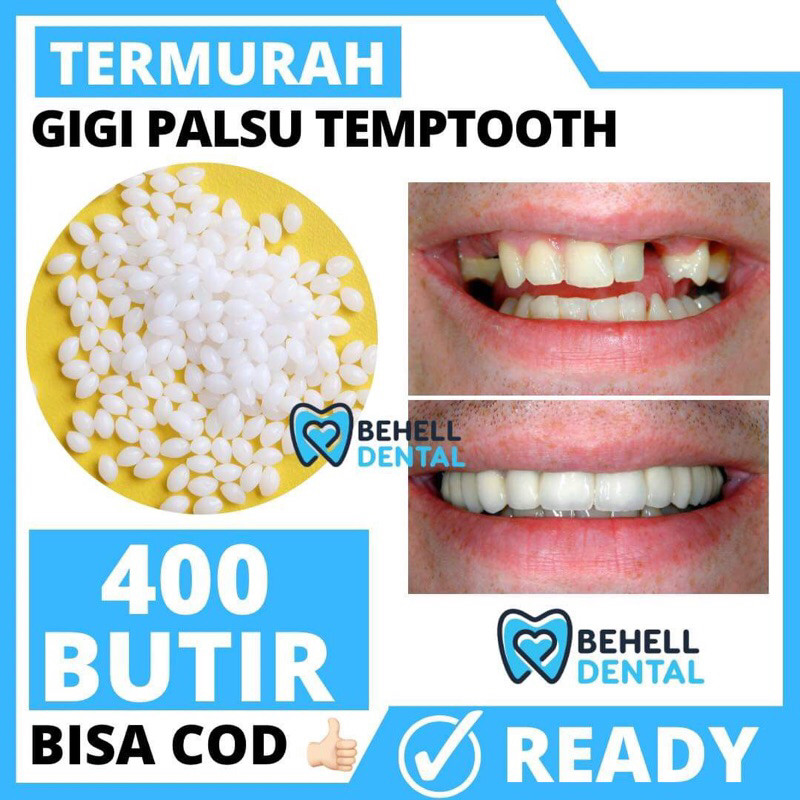 GIGI PALSU SEMENTARA 400 BUTIR / PENAMBAL GIGI PATAH RENGGANG TEMPORARY TOOTH TEMPTOOTH GINGSUL PATA