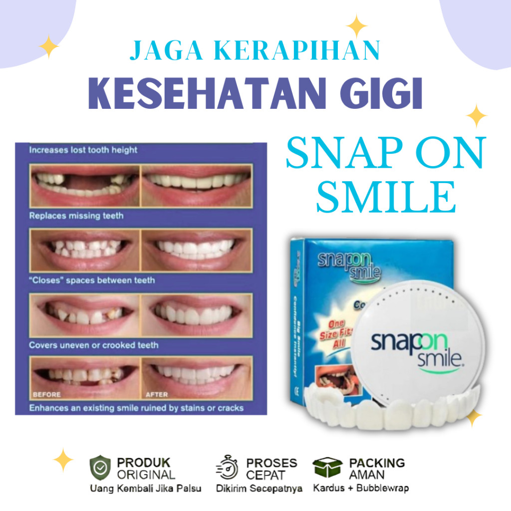 GEBYAR PROMO  ORI 100% ORIGINAL Snap On Smile Original Atas Bawah Asli Gigi Palsu Veneers Gigi Insta