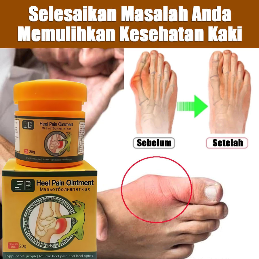 Obat Sakit Tumit Plantar Fasciitis Terapi Obat Sakit Telapak Kaki Pereda Nyeri Tumit Terapi Kaki Sal