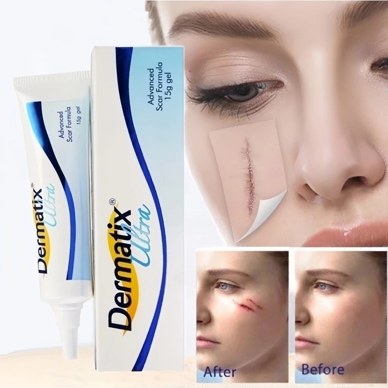 COD Dermatik Ultra / Dermatic / Dermatix Ultra 15Gr Cream Krim Penghilang Bekas Luka 15 gram strechm