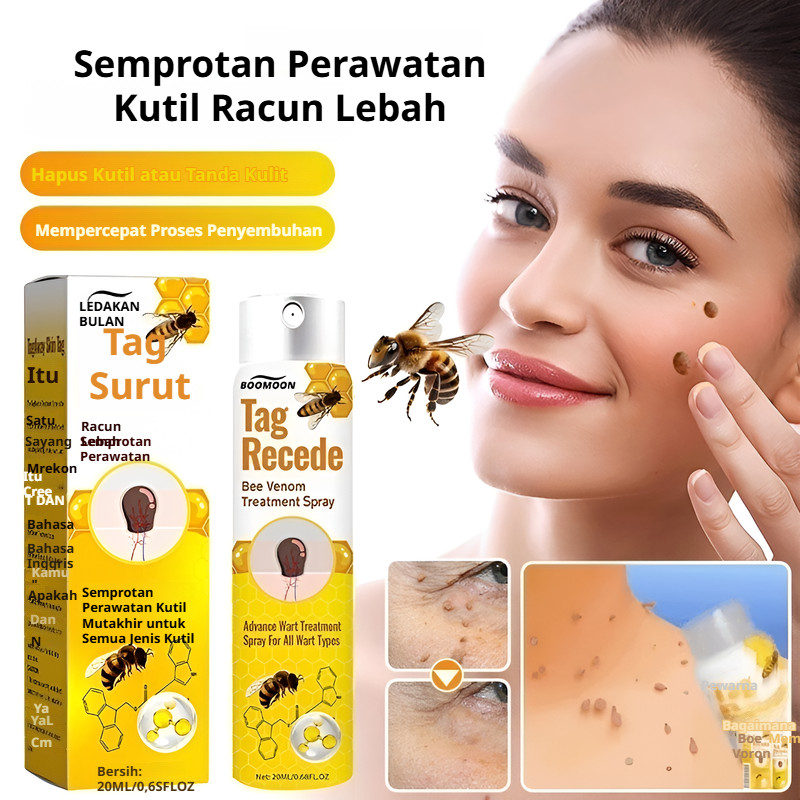 Semprotan Kutil Racun Lebah Tanpa Rasa Sakit, Krim Penghilang Kutil dan Tahi Lalat, Penghilang Kutil