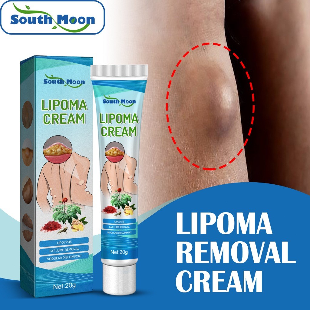 South Moon Lipoma Removal Cream Original 20g Salep Lipoma Salep Benjolan