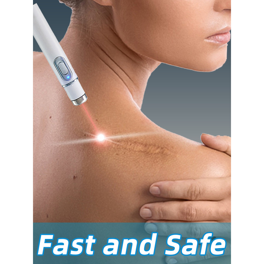 Laser Therapy Keloid Scar