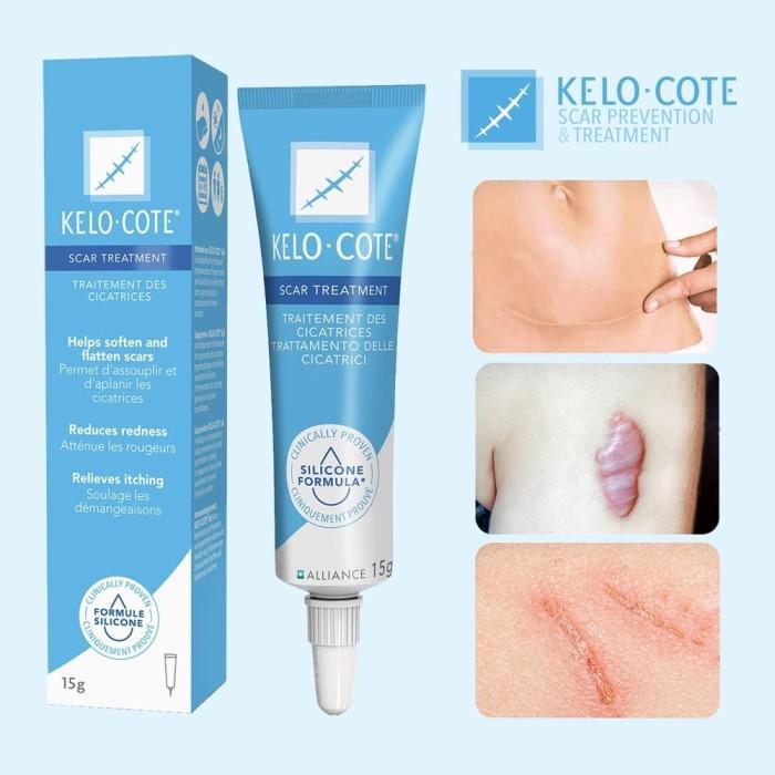 Terbaru KELO COTE GEL 15gr Cream Penghilang Bekas Luka Operasi Bekas Luka Bakar & Keloid Kelocote Ge