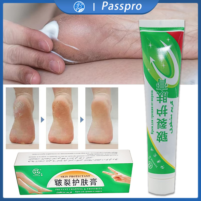 Cream Salep Obat Kaki Rayapan Ampuh Tumit Pecah Pecah Kulit Kering Mengelupas Serta Gatal Jamur