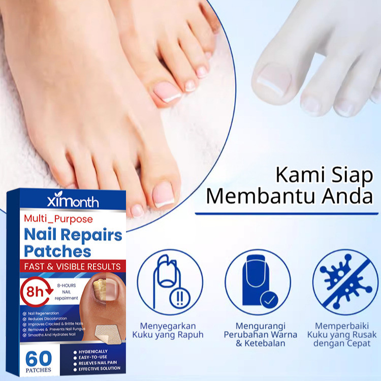 Perbaiki Kuku Rusak Dalam 3 Hari Plaster Perawatan Kuku HFH - Perawatan Kuku Rusak/Kuku Rapuh/Repara