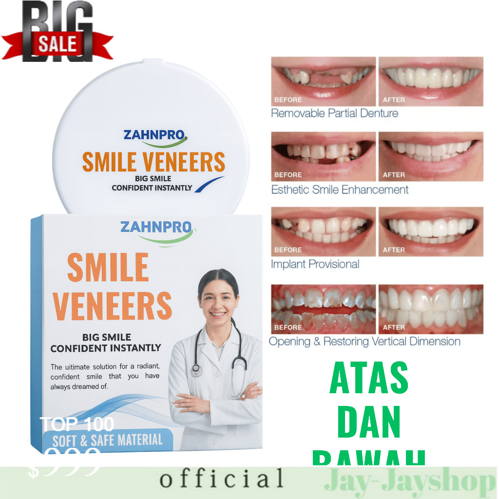 GIGI VENEER SILIKON 1 SET ATAS + BAWAH LEPAS PASANG PREMIUM