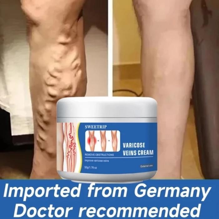 Cream Varises varikose cream nyeri varises