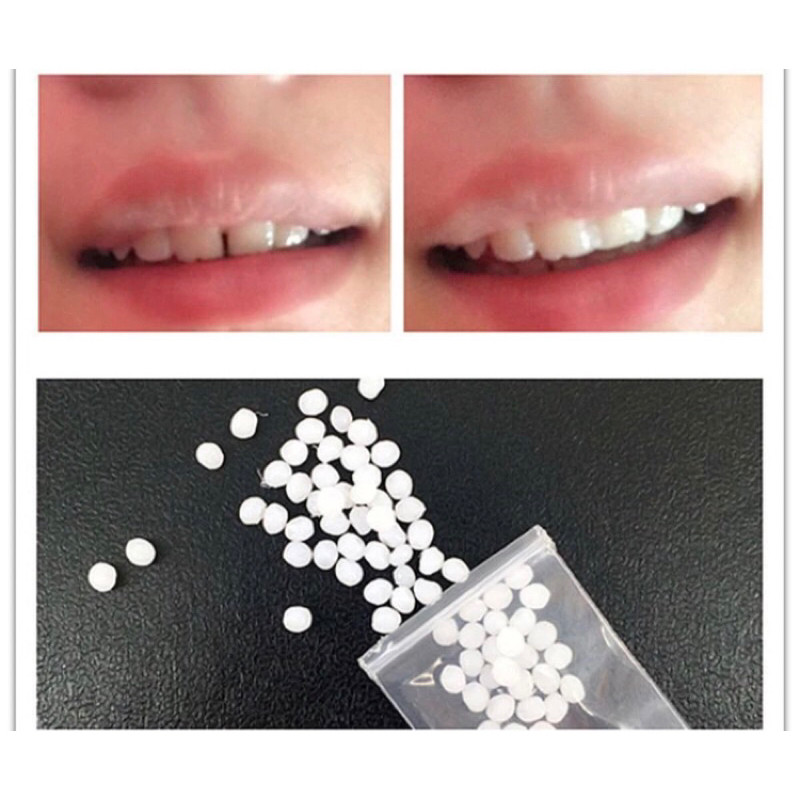 Penambal Gigi Ompong Temptooth Penambal Gigi Patah Instan / Gigi Palsu Instan /Diy Tooth