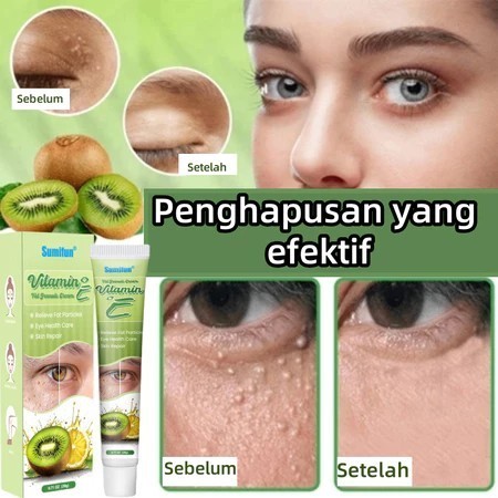 JLLZW obat milia di bawah mata cream milia penghilang milia Eye cream obat milia remover Benjolan Ke