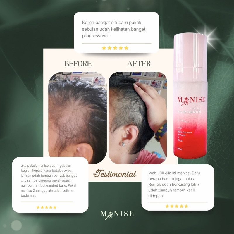 TERMURAHRONTOK BOTAK  Manise Hair Oil - CEK TESTI tonic serum minyak rambut kemiri follow me shampoo