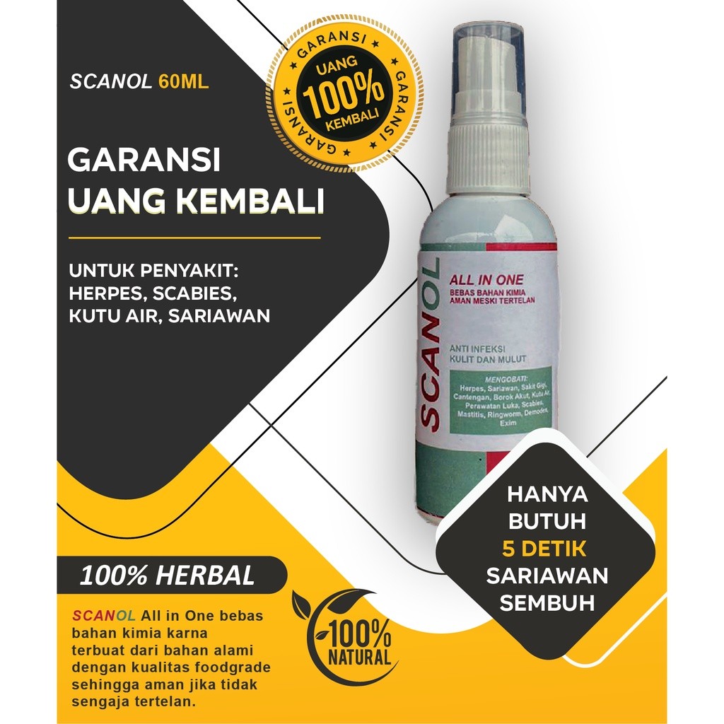 OBAT SPRAY SARIAWAN MULUT, Sariawan Bayi/Dewasa, Sariawan Bibir, Menahun Radang Sariawan, Sariawan d