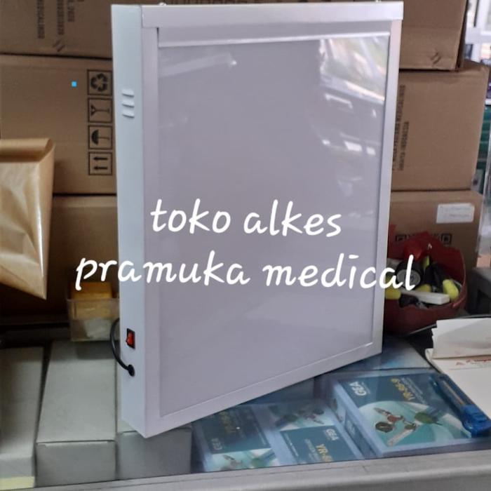 x ray viewer singgle lampu baca rontgen singgle LED