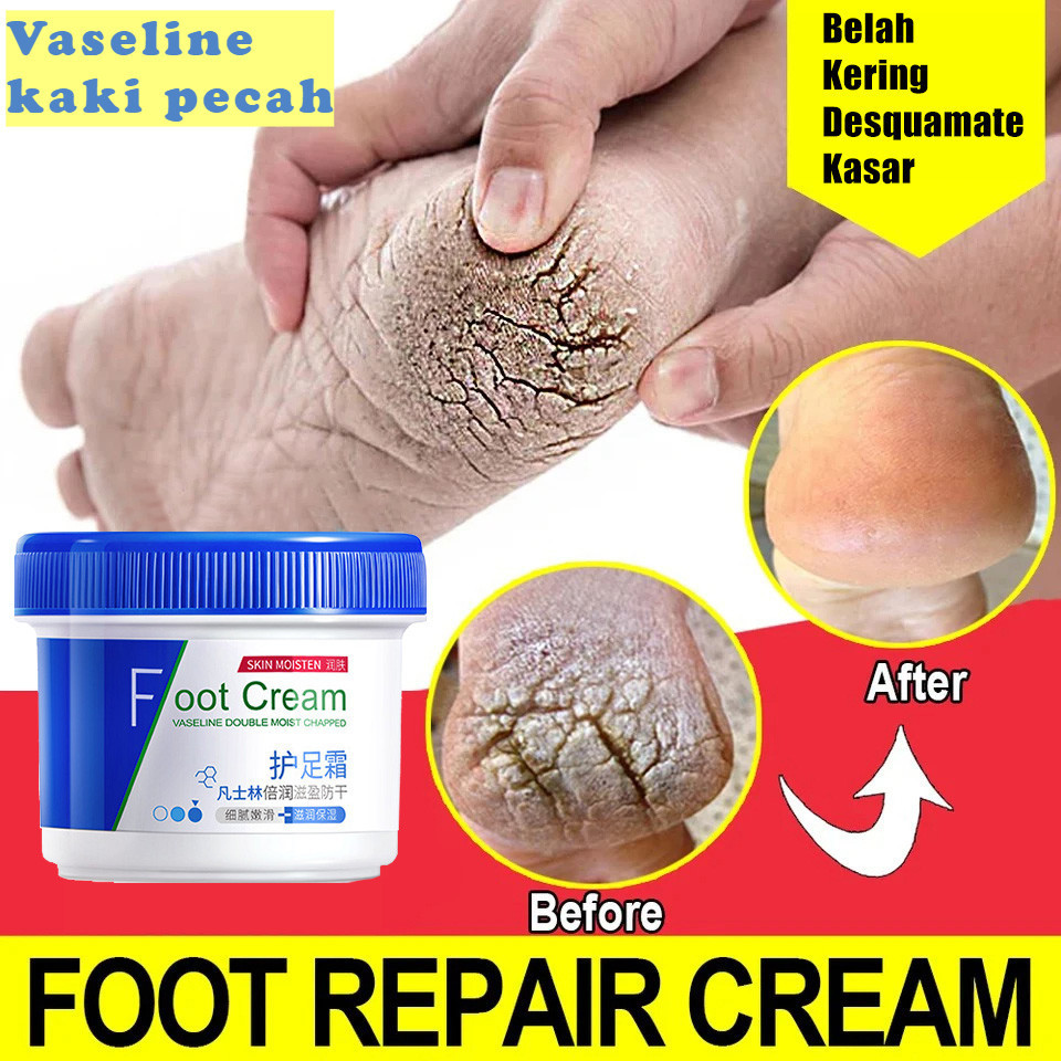 Vaseline kaki pecah dan kering Foot cream 50g Penghalus kaki kasar dan pecah kering Krim Kaki obat k