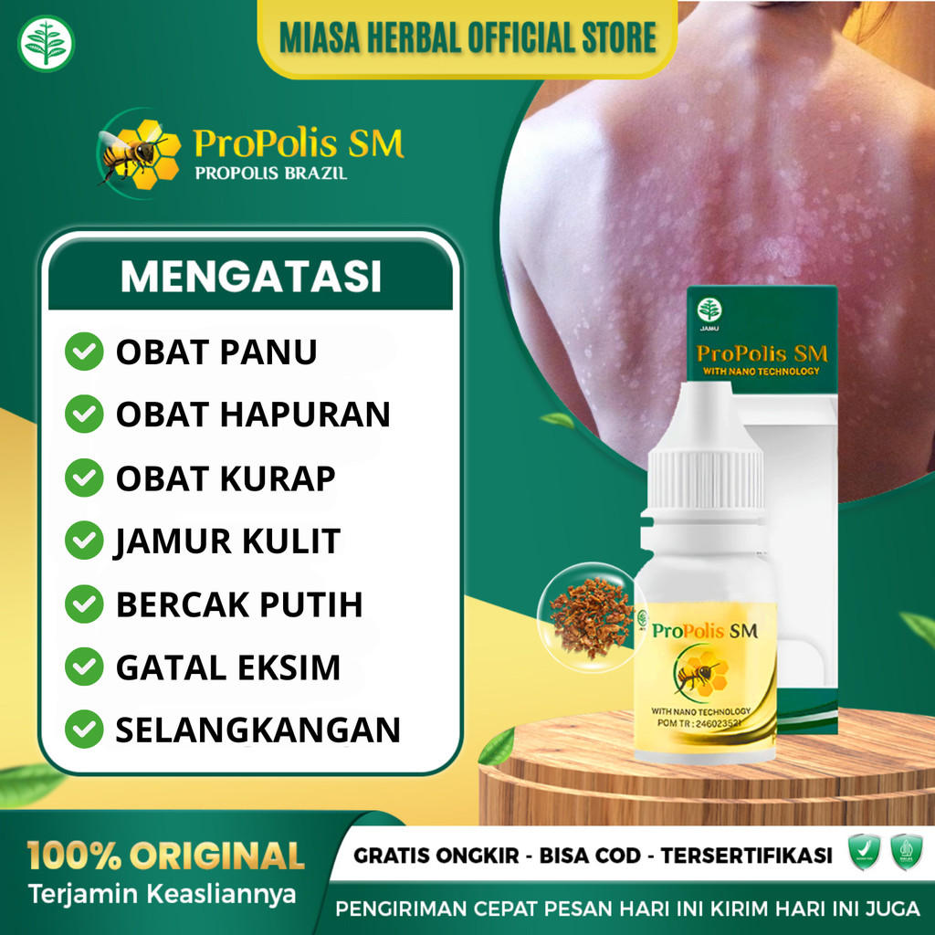 Obat Panu Obat Hapuran Kadas Kurap Obat Jamur Kulit Obat Bercak Putih Obat Gatal Menahun - Propolis 