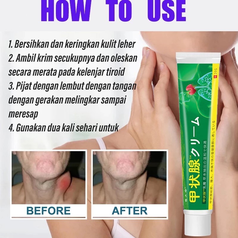 COD Jepang Salep Tiroid Obat Benjolan Di Leher Obat Gondok 20g Benjolan Di Leher Tumor Kelenjar Tiro