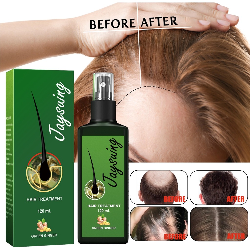 Jaysuing Hair Growth Spray 30ml/120ml Semprotan Penumbuh Rambut Obat Rambut Botak Serum Penumbuh Ram