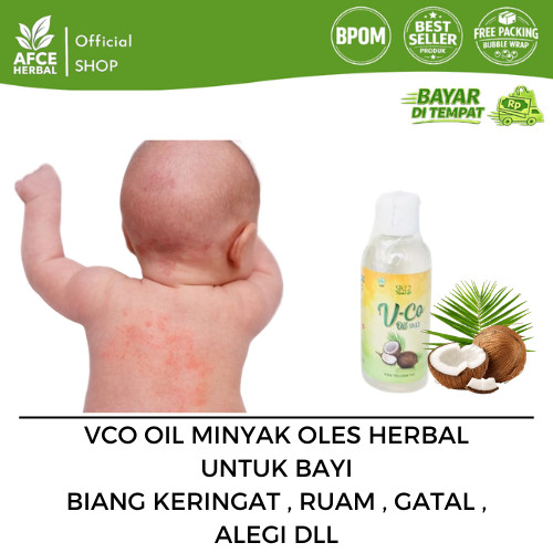 Bisa COD VCO SR12 Minyak Kelapa Untuk Bayi / Biang Keringat Bayi / Obat Ruam Popok / Minyak Urut Bay