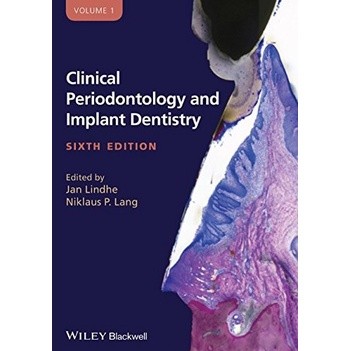 Clinical Periodontology and Implant Dentistry, 2 Volume Set 6th editio